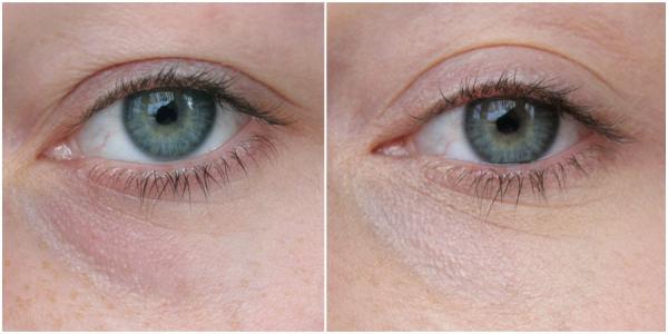 astuce anti cerne naturel astuce anti cerne naturel